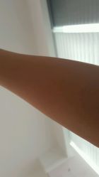 点击看大图 -咪咪比基尼脱毛专业店