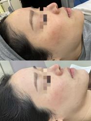 -SKIN79皮肤管理中心