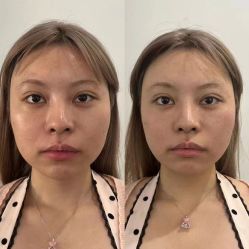 -LUNA皮相美·骨相美高级美感