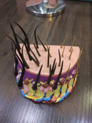 -雍禾植发全国连锁