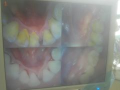 -赫尔森口腔·牙齿种植修复