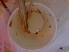 iphone_upload_pic-冯姐生蚝(迎宾广场店)
