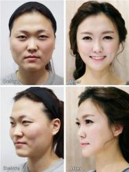 -CMS西美斯·美式医疗美容