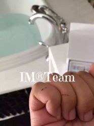 英树玻尿酸羊胎素专营化妆品-英树玻尿酸羊胎素专营化妆品