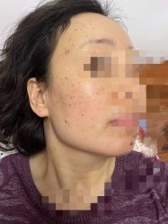-荟草堂专业痘肌皮肤管理