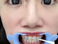 -Dr.Z dental仁康种植矫正中心