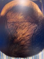 -雍禾植发全国连锁