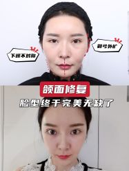 -上海时光整形外科医院