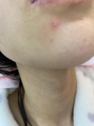 体验后-重庆军美医疗美容医院