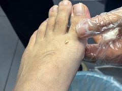 -世龙世家甲沟炎·灰指甲·嵌甲矫正·修脚(武侯区双楠店)