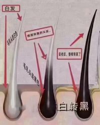 -希梵尔头皮抗衰·科技养发