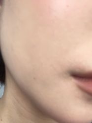 -广州美莱医疗美容医院