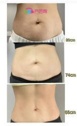 -产后帮产后修复(首城国际店)