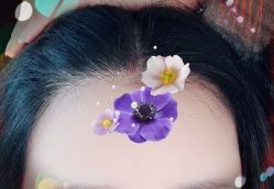 -大麦微针植发全国连锁