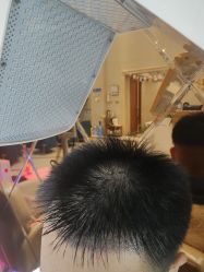 -碧莲盛·不剃发植发