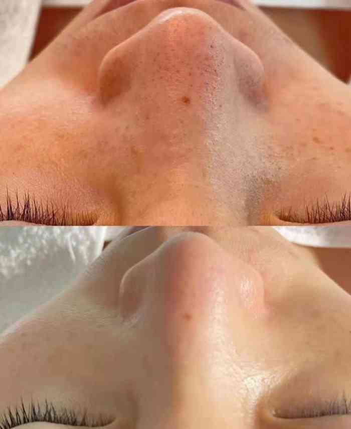 奥菲丽亚·科技美肤(常营店)-"跟朋友一起提前约了周末时间,来打卡