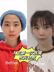 -广东韩妃整形外科医院