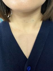体验前-上海首尔丽格医疗美容医院