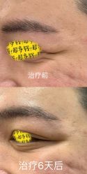 体验前-中加科洋医疗美容