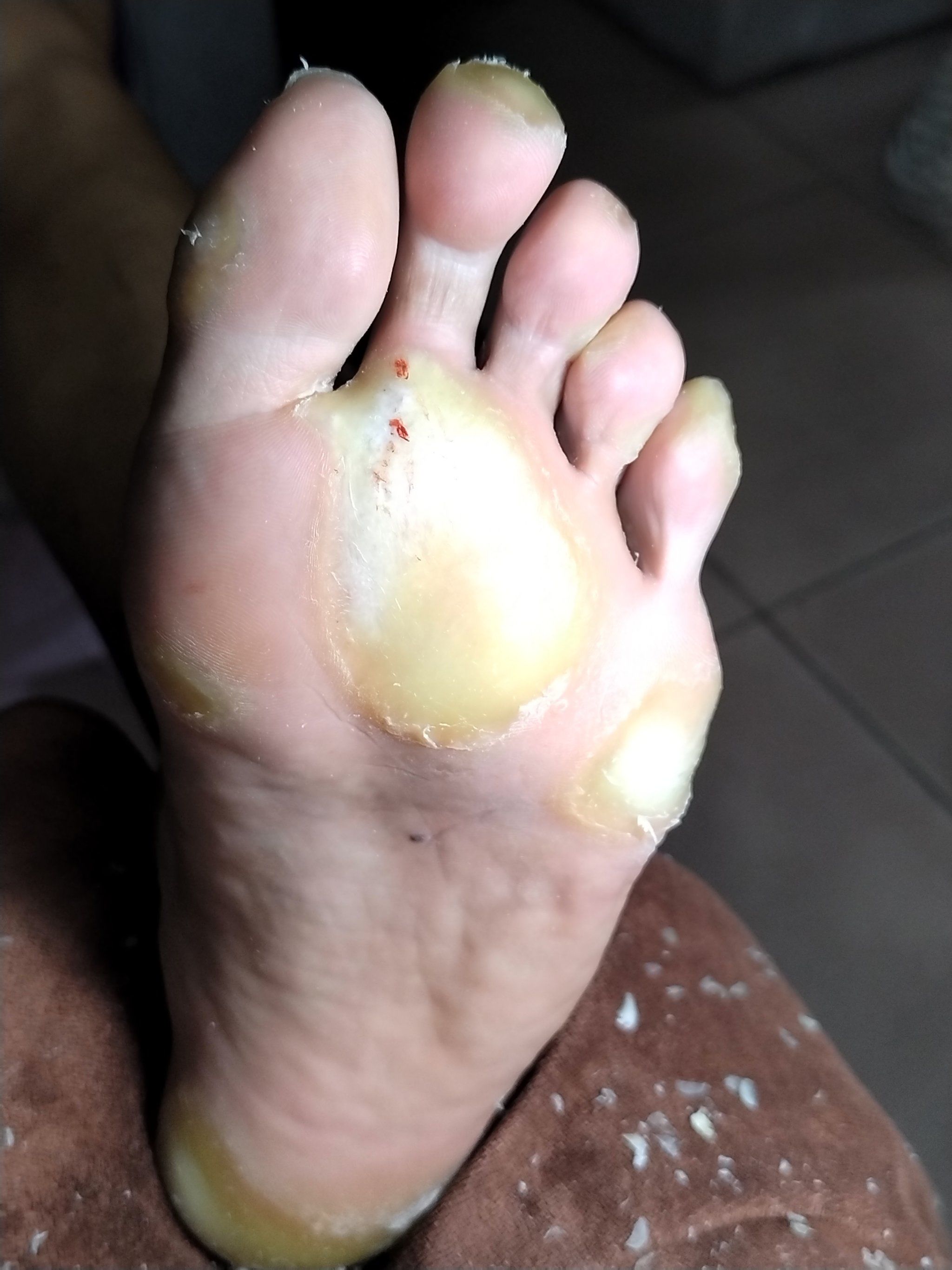 这样的脚病医院也搞不定的,只有我能帮你搞