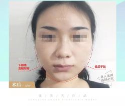 -圣嘉新医疗美容医院