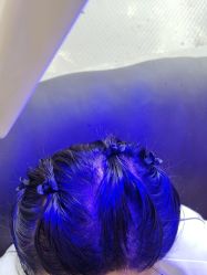 -碧莲盛·不剃发植发