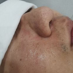 -苗方清颜专业祛痘·皮肤管理