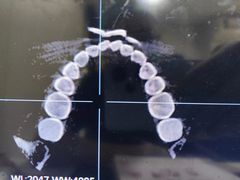 -同步齿科·数字化正畸种植口腔中心(前山店)