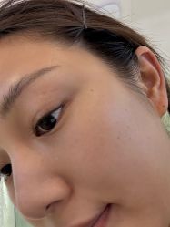 -长沙雅美医疗美容医院