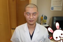 点击看大图 -大麦微针植发丨全国连锁