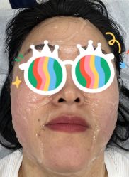 点击看大图 -洁铭新加坡医美