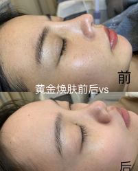 -SKIN79皮肤管理中心