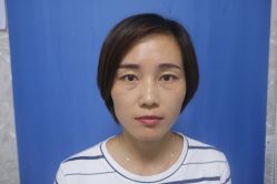 -广州健丽·去眼袋医疗美容机构