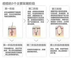 -痘庄科学祛痘国际连锁机构