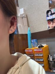 -痒刺青