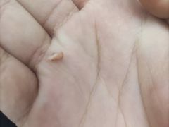 -新甲连锁灰指甲·甲沟炎·鸡眼(黑龙江路店)