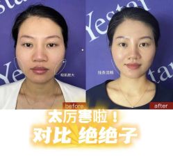-Yestar杭州艺星医疗美容医院