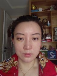 体验后-北京炫美医疗美容