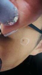 -More摩尔医美の注射线雕光电中心