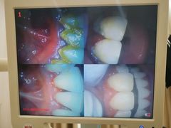 -赫尔森口腔·牙齿种植修复