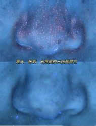-SKIN79皮肤管理中心