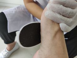 -派恩宜灰指甲鸡眼嵌甲手足癣