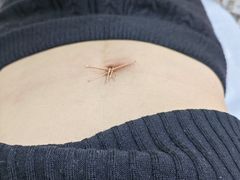 -浙江省中医院(湖滨院区)