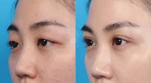 -SKINIST丽铂医疗美容