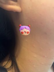 体验后-Yestar 嘉兴艺星医疗美容医院