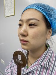 -天津健丽·去眼袋医疗美容机构