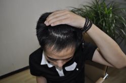 -大麦微针植发丨全国连锁