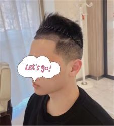 -大麦微针植发丨全国连锁