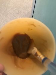 -肥三针腧穴瘦身馆