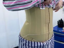 体验后-西安壹加壹医疗美容医院